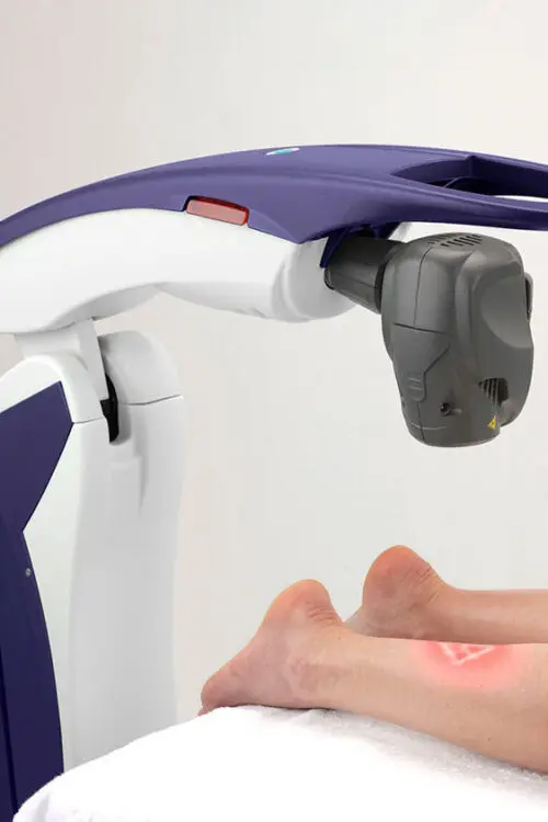 MLS_Laser_Application_LowerLeg1