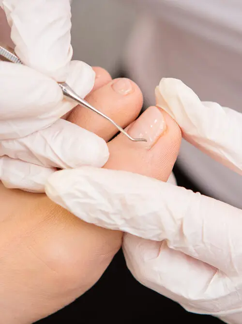 nail-surgery1
